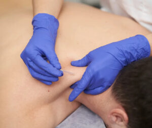 Vibefisoterapia